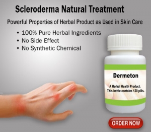 Natural Treatment for Scleroderma